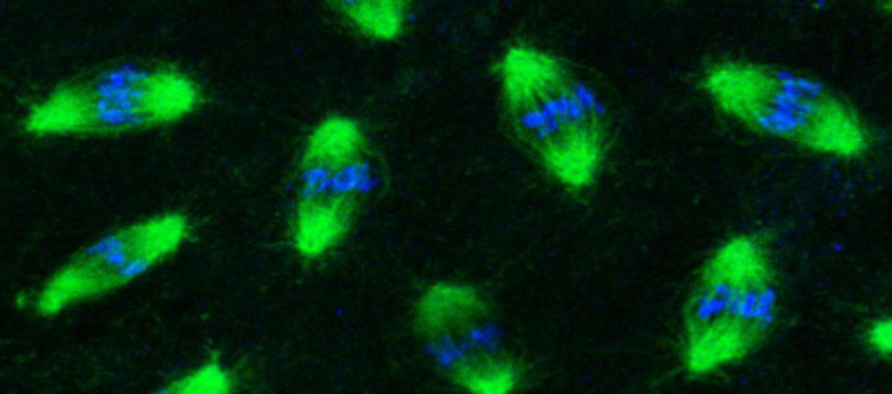 metaphase