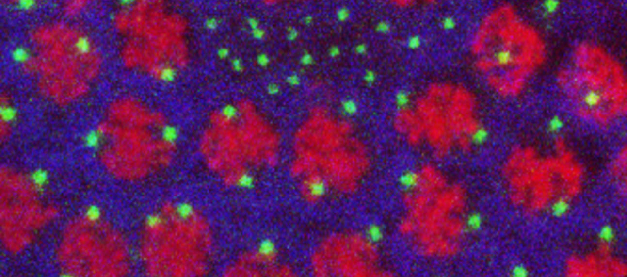 prophase
